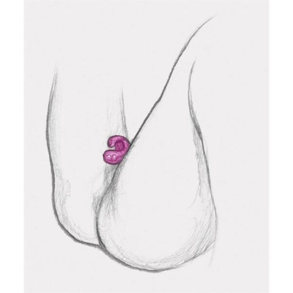 Anillo Gring XL Sweet Raspberry - Imagen 10